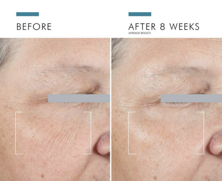 SkinCeuticals Advanced Eye