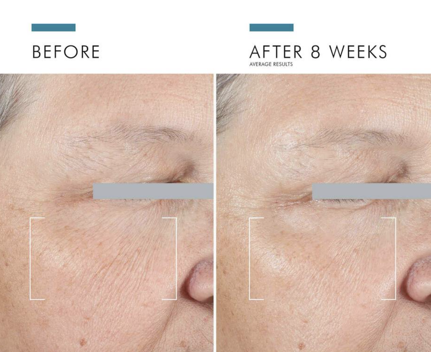 SkinCeuticals A.G.E. Advanced Eye – Skin Solutions Dermatology