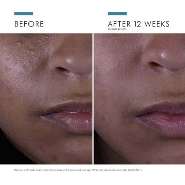 SkinCeuticals Silymarin Gallery 2