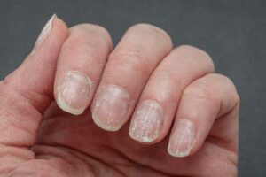 nails image (1)