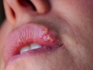 shutterstock 2184074365 scaled