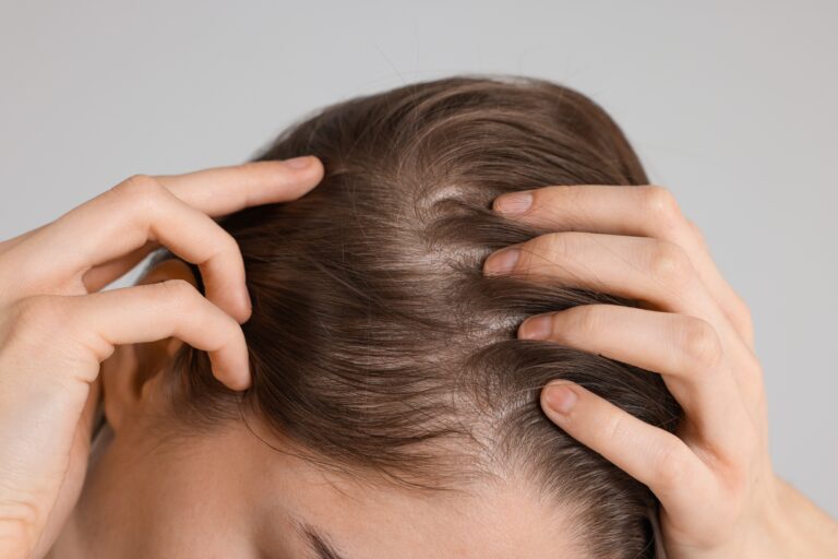 girl,with,hair,loss,problem,on,grey,background,,closeup