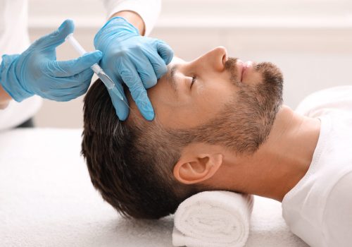 PRP for hair loss