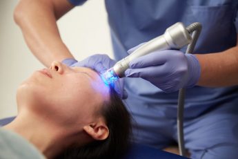 RF Microneedling RF Microneedling